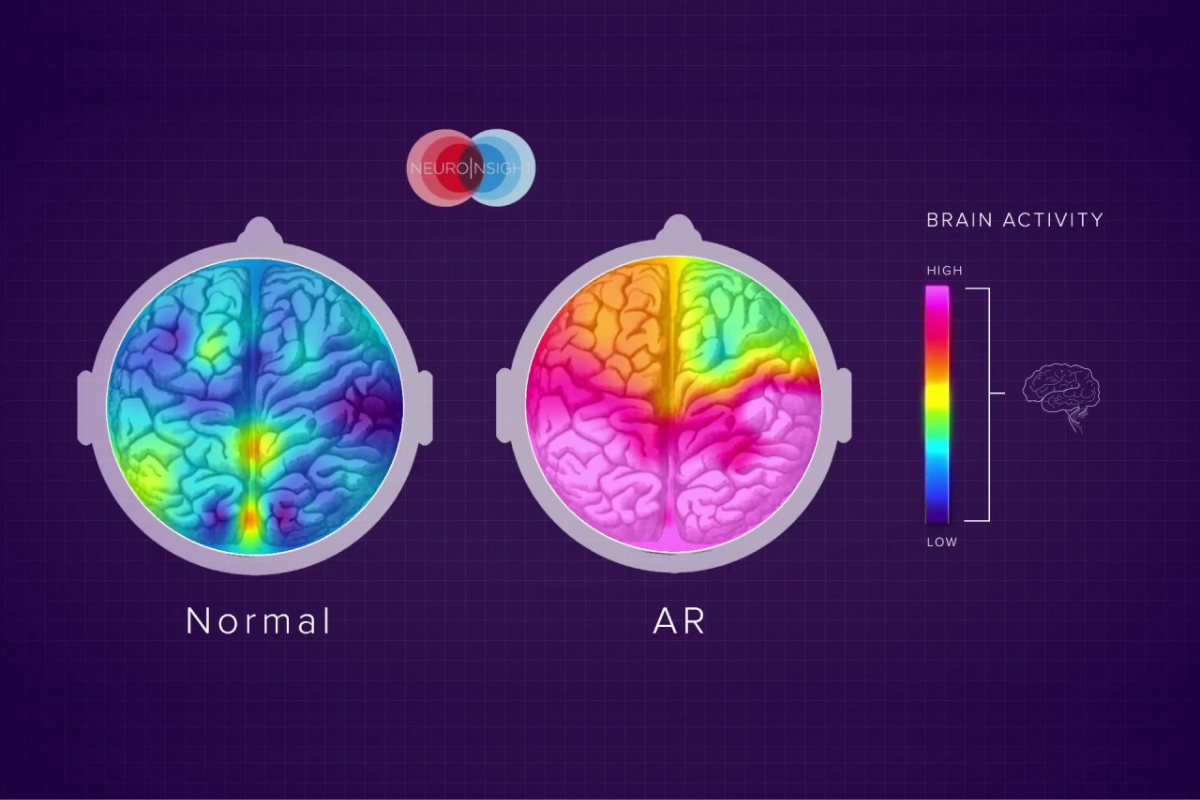 Your Brain On AR 1200X
